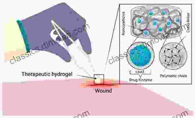 Nanoengineered Biomaterials For Accelerated Wound Healing Nanoengineered Biomaterials For Regenerative Medicine (Micro And Nano Technologies)